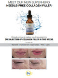 Needle-Free Collagen Filler